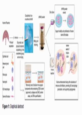 INJECTABLE EXTRACELLULAR MATRIX MICROPARTICLES FOR REGENERATIVE AND BIOCOMPATIBLE SOFT TISSUE AUGMENTATION